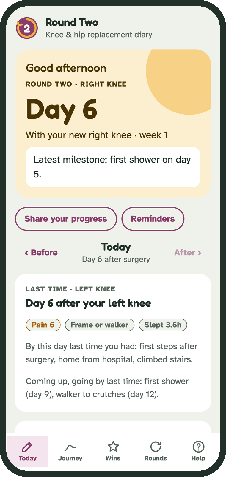 The Round Two app on day 6 after a right knee replacement. Below the day count, it shows what was written on day 6 after the left knee: pain 6, walking with a frame, and the milestones reached by then.